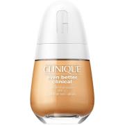 Clinique Even Better Clinical Serum Foundation SPF20 WN 114 Golden - 3...